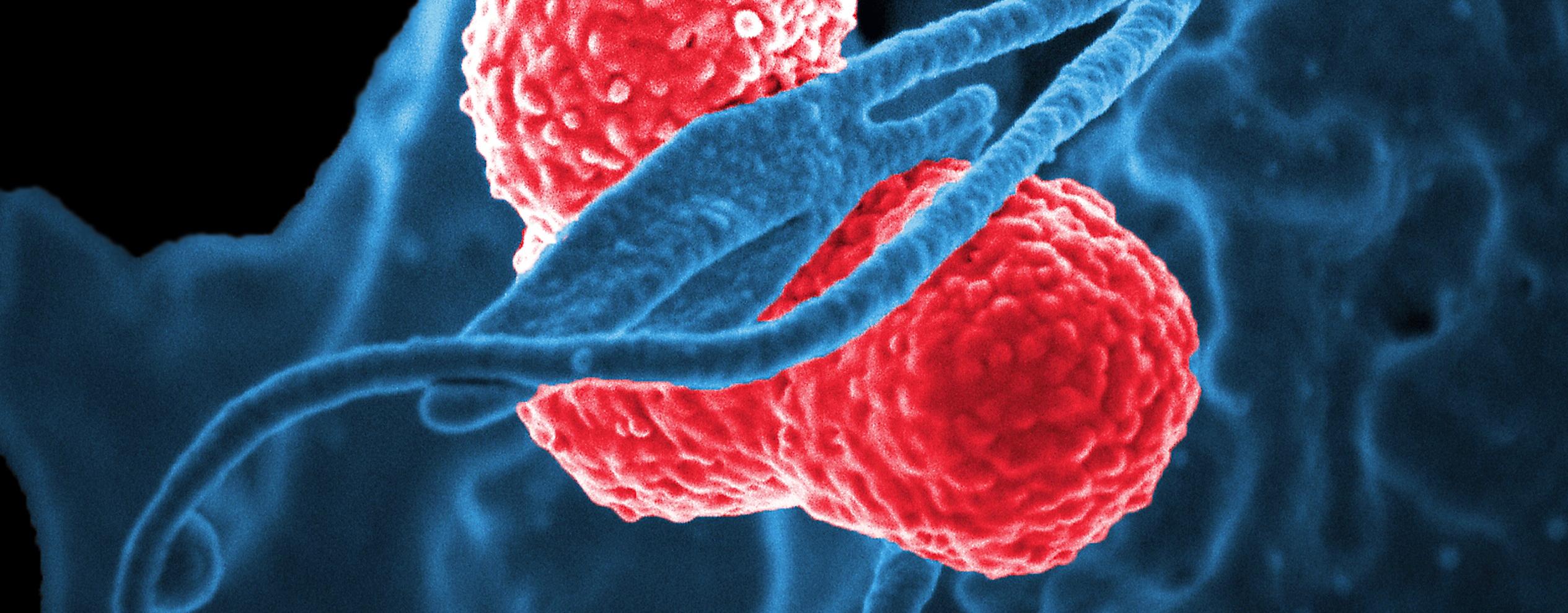 A scanning electron microscopic image, depicting a blue-coloured, human white blood cell, interacting with two pink-coloured, rod shaped, multidrug-resistant, Klebsiella pneumoniae bacteria