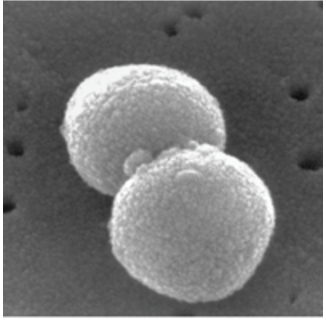 Streptococcus pneumoniae